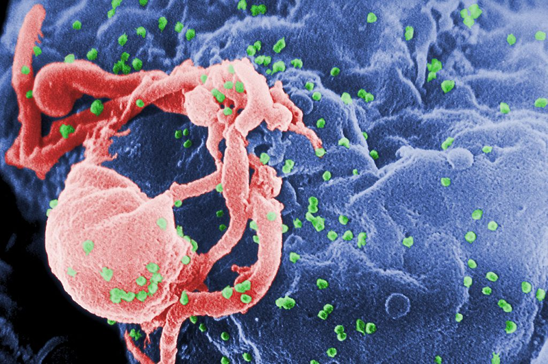 Illustration for article titled Hell yeah, Evolution! HIV may be getting less virulent.
